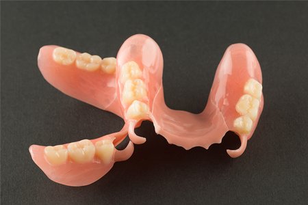 ノンクラスプデンチャー